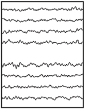 Normal EEG tracing.