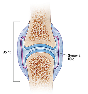 Cross section of healthy joint showing joint capsule and synovial fluid.