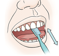 Closeup of mouth showing toothbrush brushing behind top incisors.