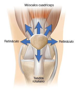 Vista delantera de una articulación de la rodilla normal con flechas que muestran fuerzas que jalan de manera uniforme de la rótula.